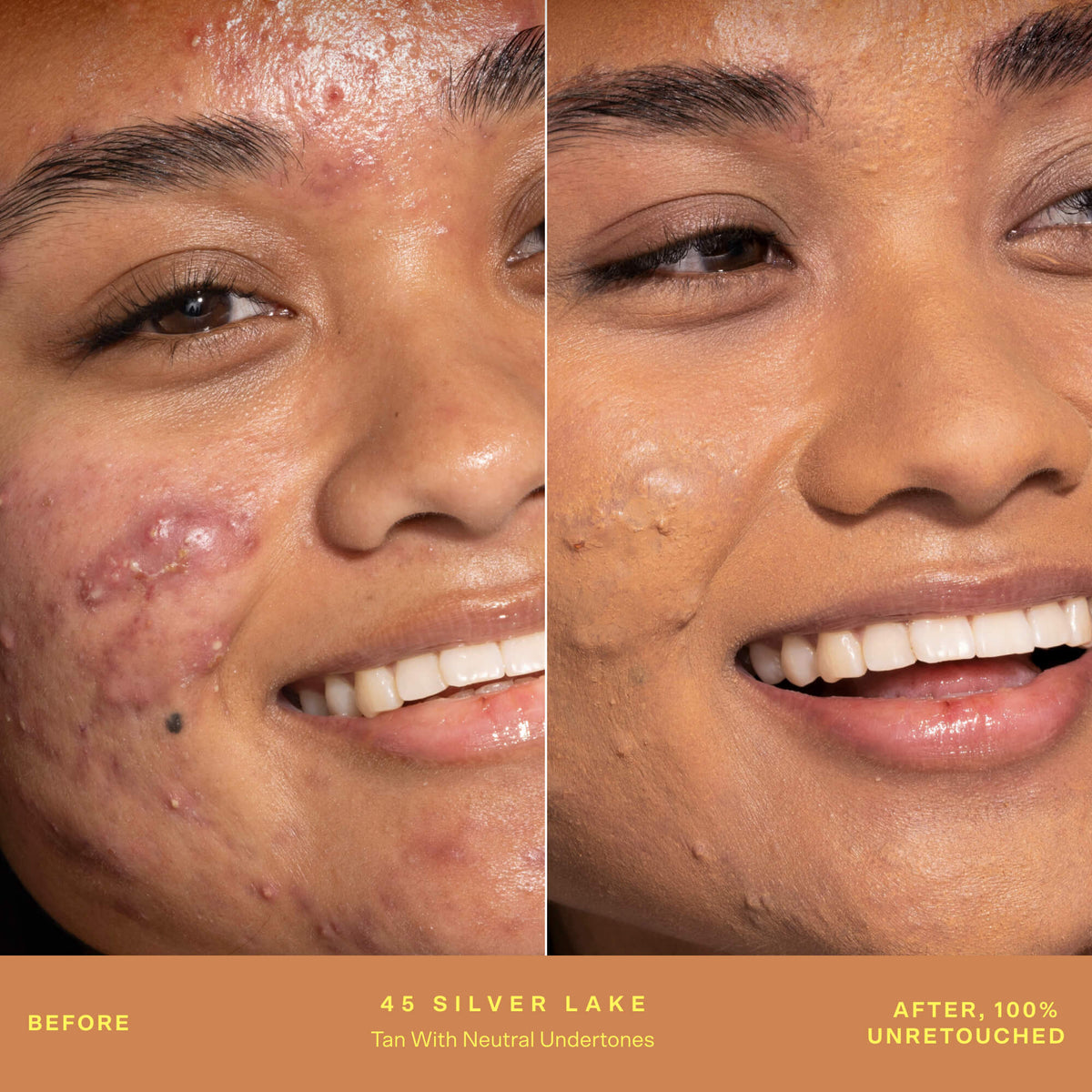 SunnyDays™ Tinted SPF 30 H5