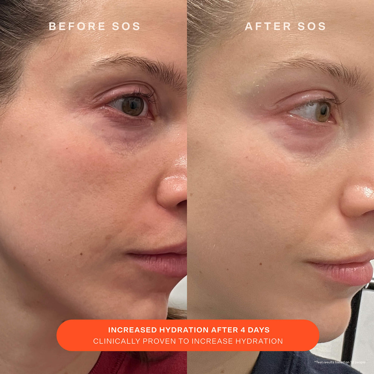 SOS Recovery Cream B3