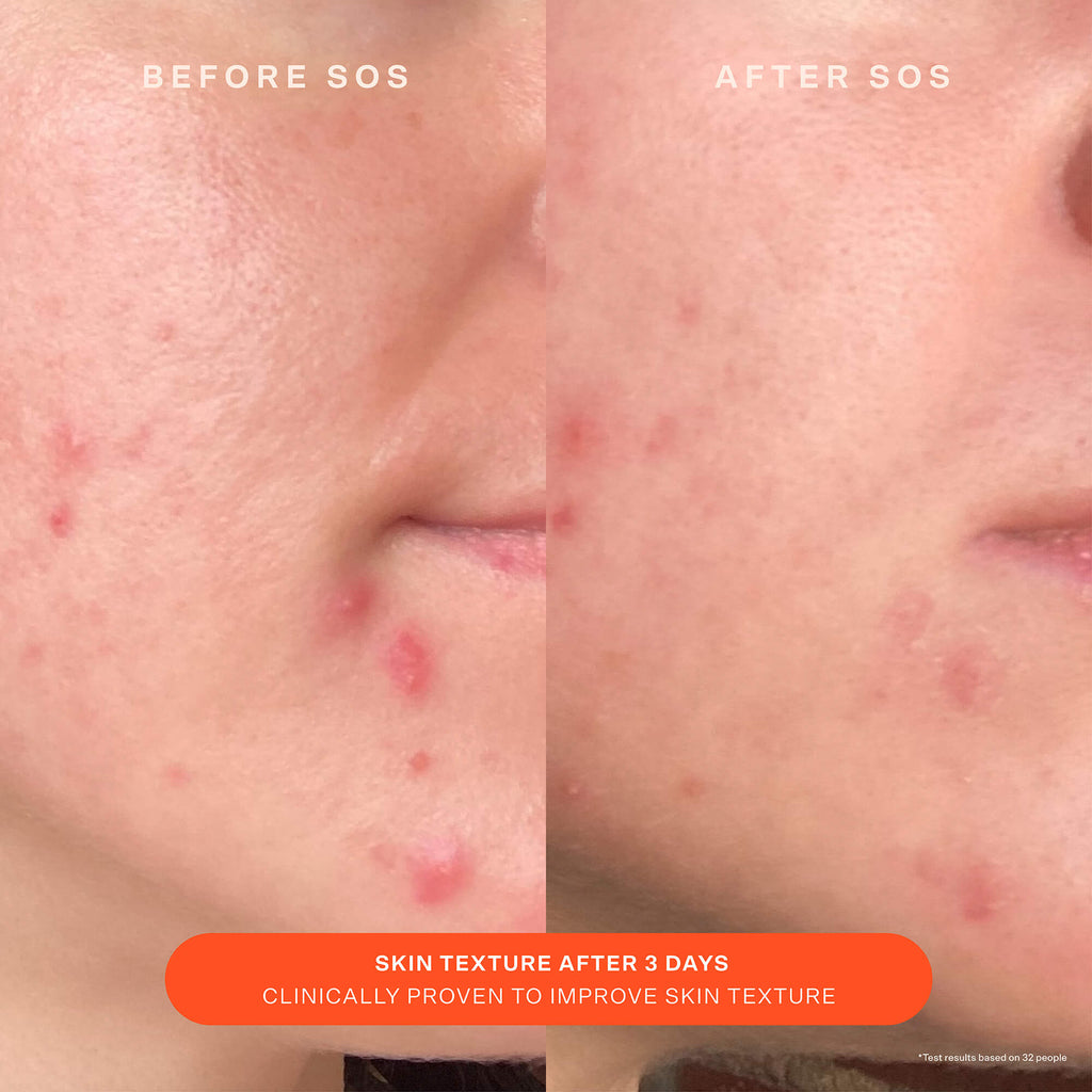 SOS Recovery Cream B3