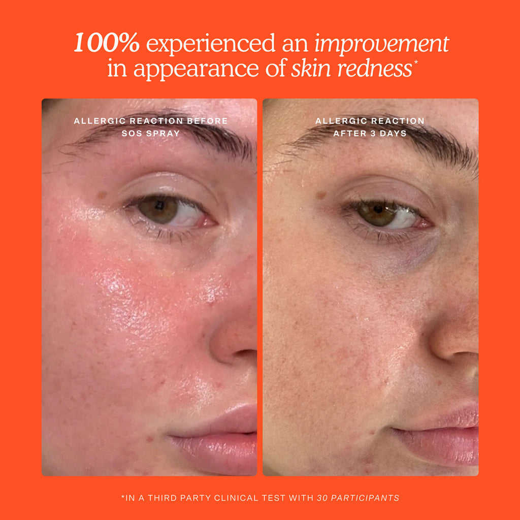 SOS 3-Step Skincare Set L6