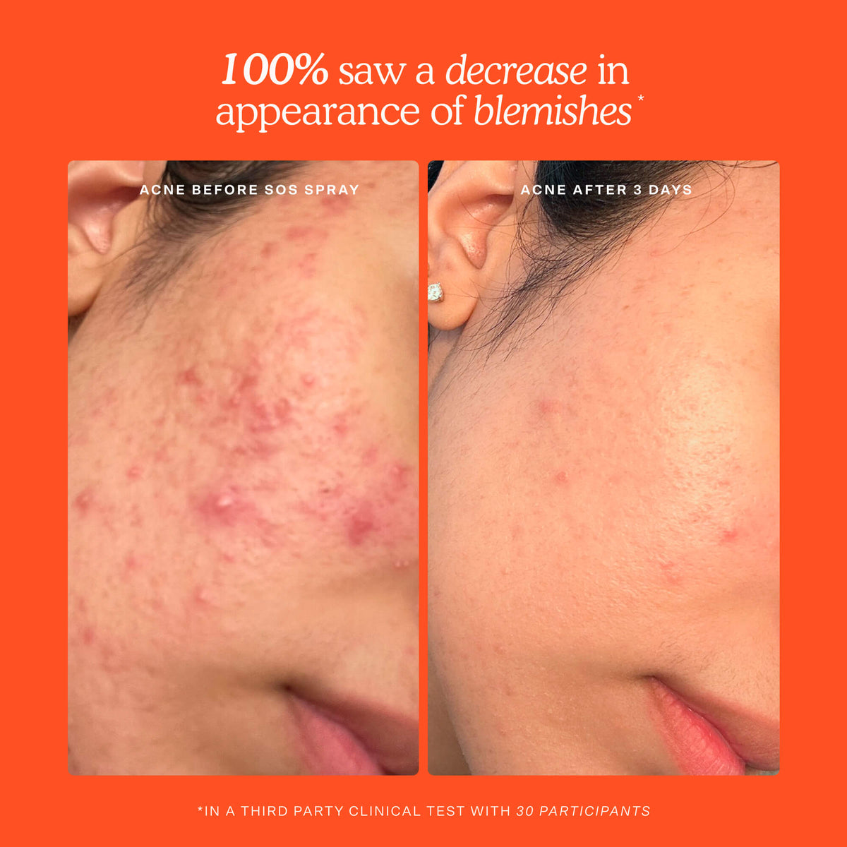 SOS Skincare Minis Kit P6