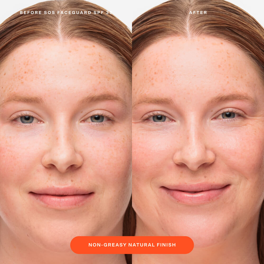 SOS FaceGuard™ SPF 30 Sunscreen PA+++ I2