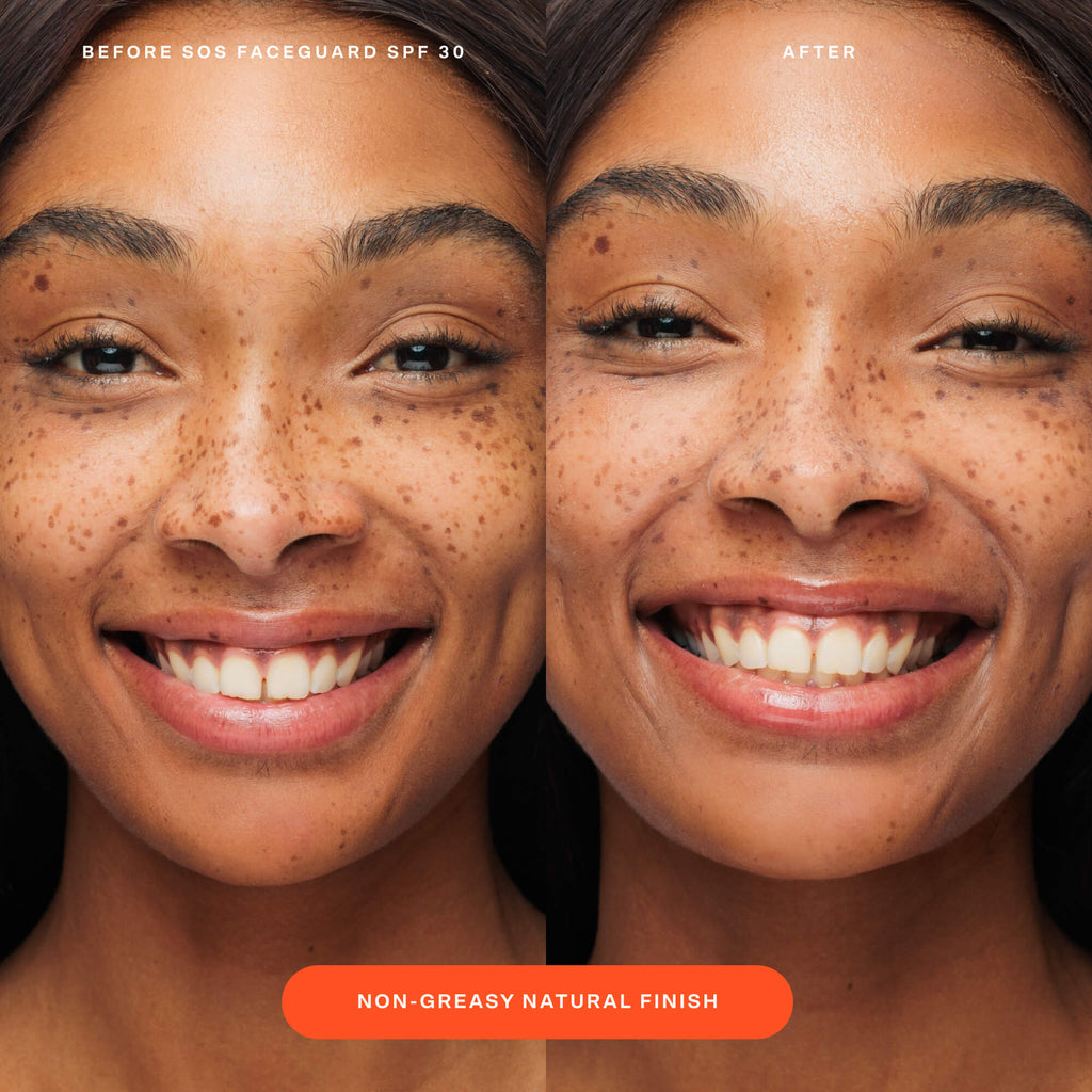 SOS FaceGuard™ SPF 30 Sunscreen PA+++ I2