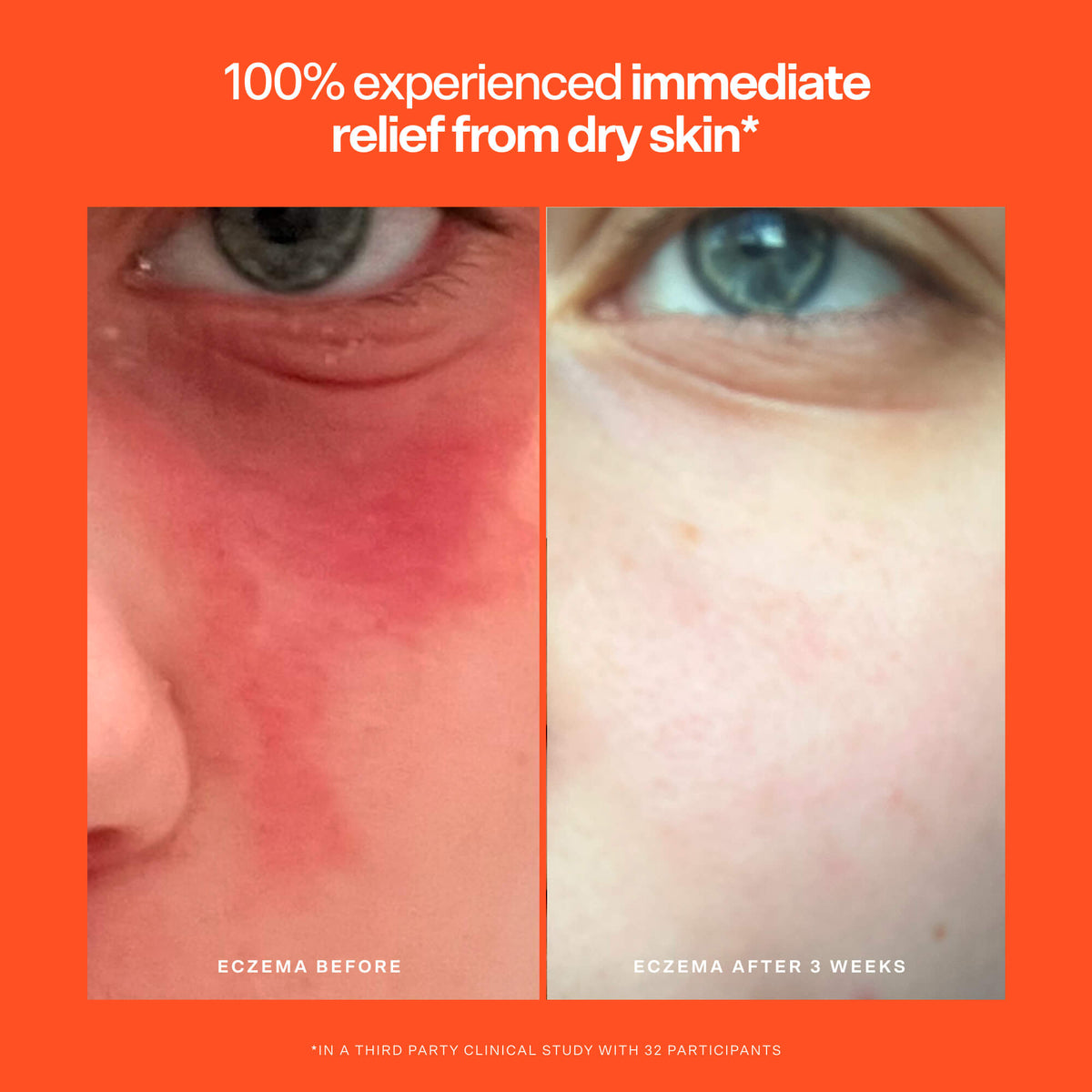 SOS Rescue Serum I0