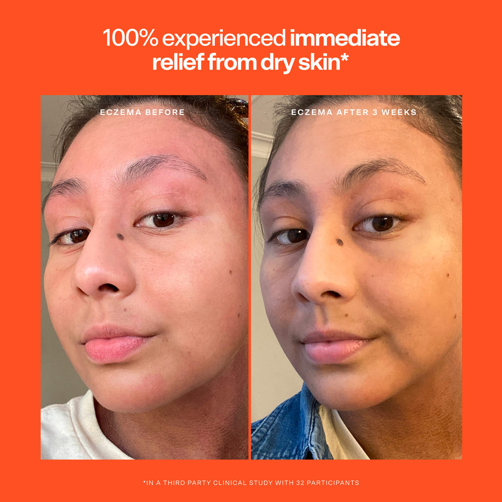 SOS Rescue Serum I0