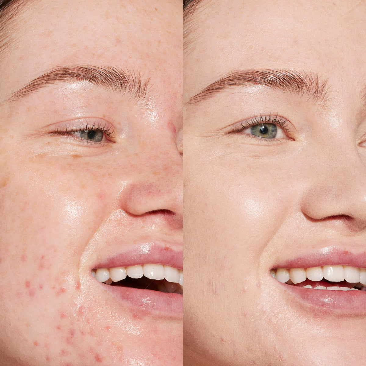 Swipe Serum Concealer® G7